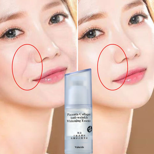 法令纹抬头纹Yukeido提拉紧致