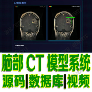 脑部肿瘤ct识别系统yolov8模型数据分析flask深度学习python源码