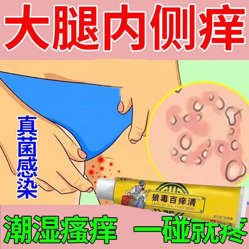 狼毒百痒快速止痒百痒清皮肤瘙痒外用干燥全身干痒百草特效抑菌膏