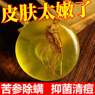 老山苦参除螨皂洗脸控油肥皂去螨虫洗澡手工香男女参祛痘硫磺肥皂