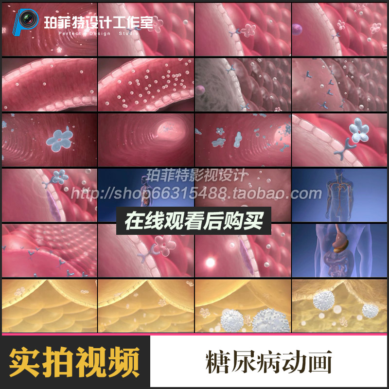 糖尿病动画医学疾病研究演示发展过程实拍视频素材