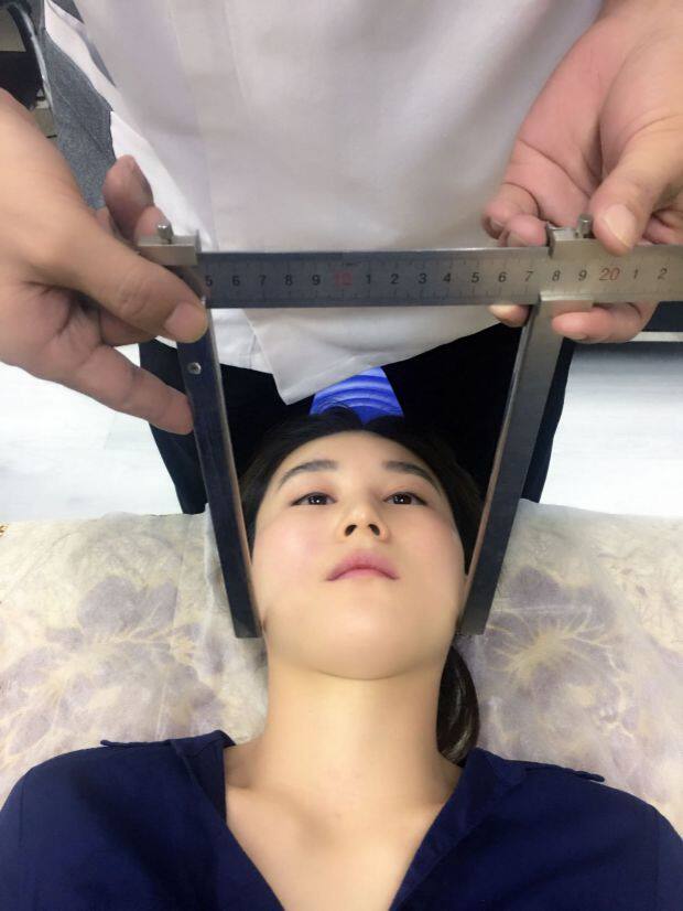 特价小颜整骨卡尺面部卡尺盆骨测量尺徒手整形专用量胯部包裹宽度