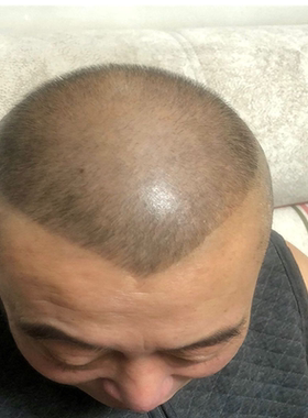 成人理发模型锅盖头椭圆形
