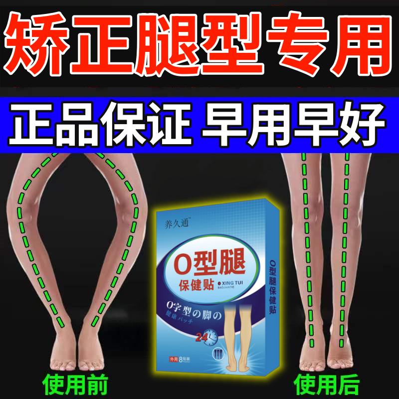O型腿矫正贴鞋垫纠正小腿