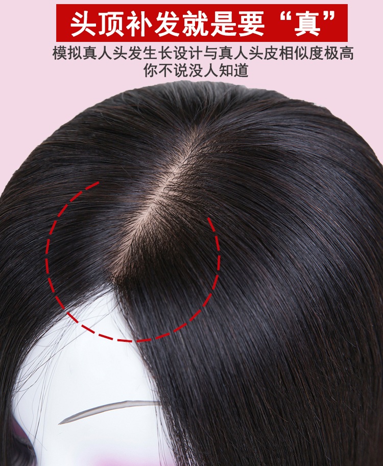头顶补发真发遮白发刘海补发块