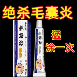 毛囊头上长脓包疙瘩头癣疮毛囊发堵塞抑菌止痒痘痘乳膏