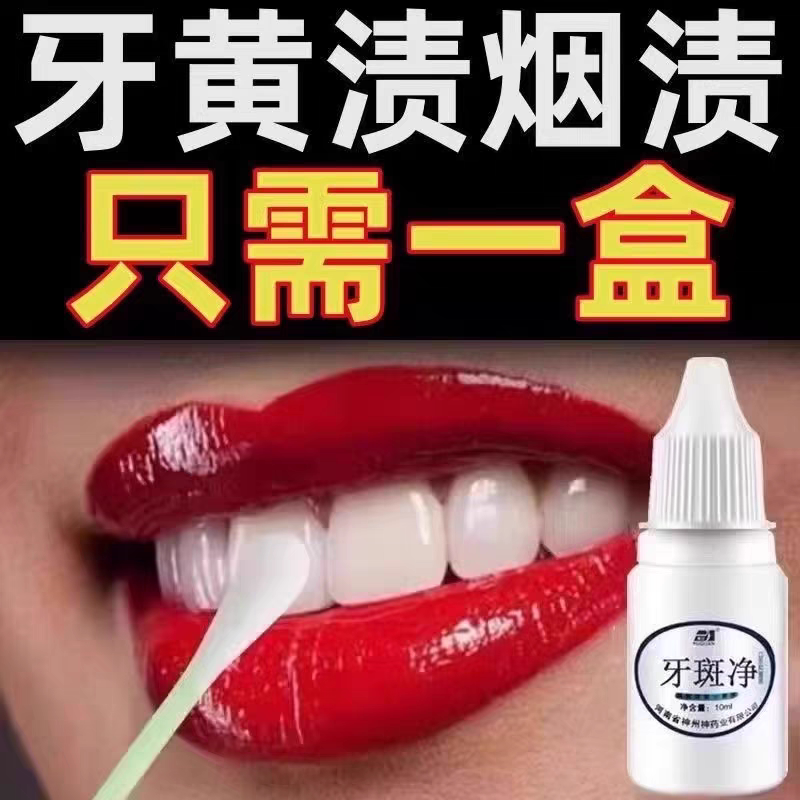 去牙渍神器烟渍去黄亮白牙齿牙斑净黄黑牙速效去除茶渍洗牙水