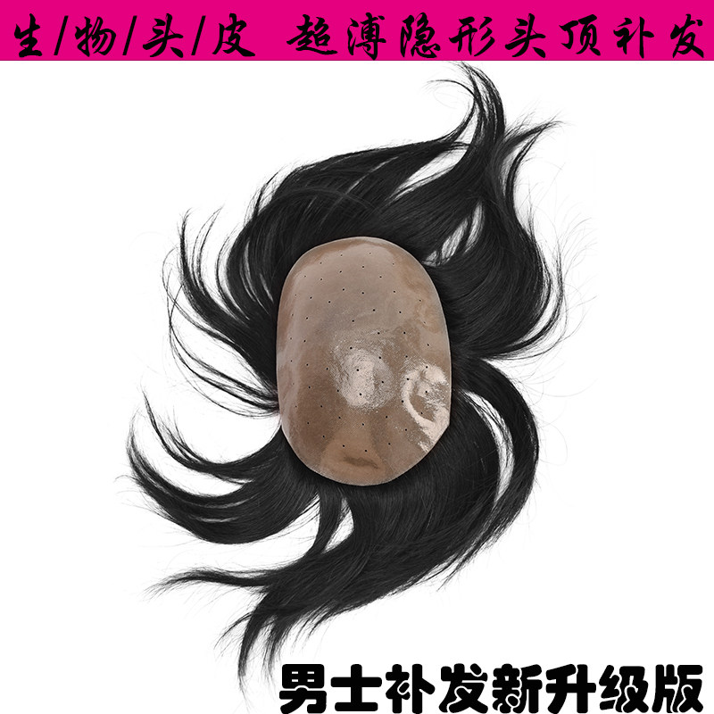 生物头顶补发隐形男士织以