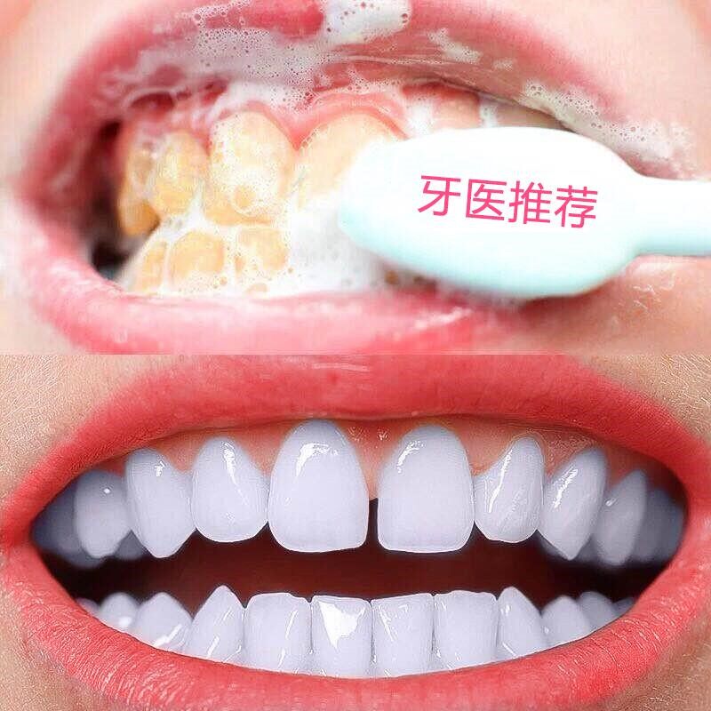小红书推荐 牙白人更美 白牙神器 齿白唇红 牙白不求人 买2送1|ruв категории туалетные чище/санитарно - гигиенических салфеток/бумага/Ароматерапия, шампунь/человек чистой, полости рта, зубная паста - от Buy2taobao.com для оказания профессиональной услуги покупки агента Taobao