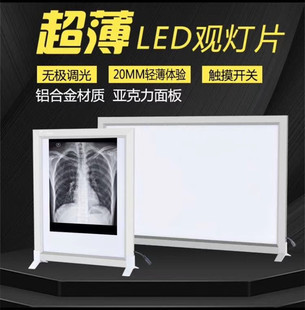 包邮超薄LED观片灯X光观片灯led阅片灯单联双联
