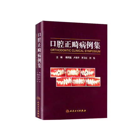 口腔正畸病例集 傅民魁满毅阻塞性睡眠呼吸暂停ii类错颌病例病历方案设计口扫隐适美隐形矫治矫正技巧专业医学书籍当代口腔正畸学