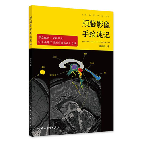 颅脑影像手绘速记 徐桂兴人卫头颅外科神经mri诊断解剖ct读片脑部脑血管重症超声颅内肿瘤图谱放射技术中级人民卫生出版社医学影像