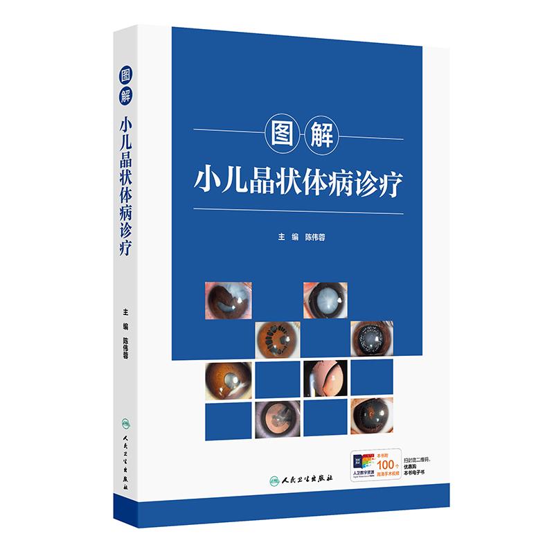 图解小儿晶状体病诊疗 陈伟蓉先天性白内障专科检查手术麻醉诊断裂隙灯眼部图像视觉康复人民卫生出版社儿童眼科学