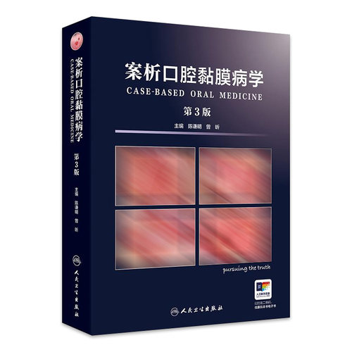 案析口腔黏膜病学第3版上颌窦溃疡感染变态反应性疾病修复保护损害诊断图鉴诊疗指南案例白斑人民卫生出版社牙科牙齿专业口腔书籍