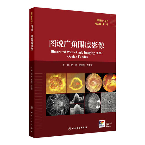 图说广角眼底影像文峰张雄泽吉宇莹视网膜病变眼底炎症感染遗传性玻璃体人民卫生出版社影像诊断学专业眼科医师参考工具书临床全彩