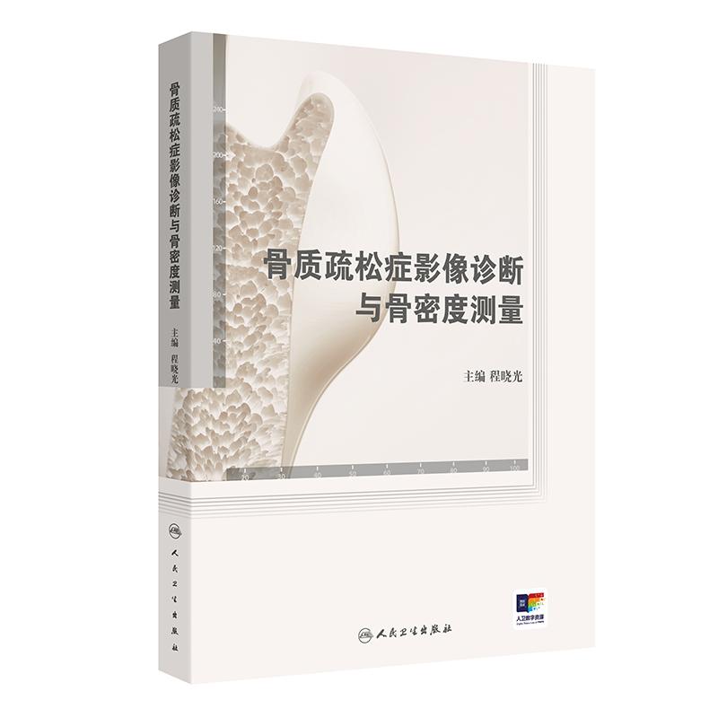 骨质疏松症影像诊断与骨密度测量 程晓光主编 详细介绍骨质疏松症的各种影像检查技术X线平片CTMRI 9787117355162 人民卫生出版社