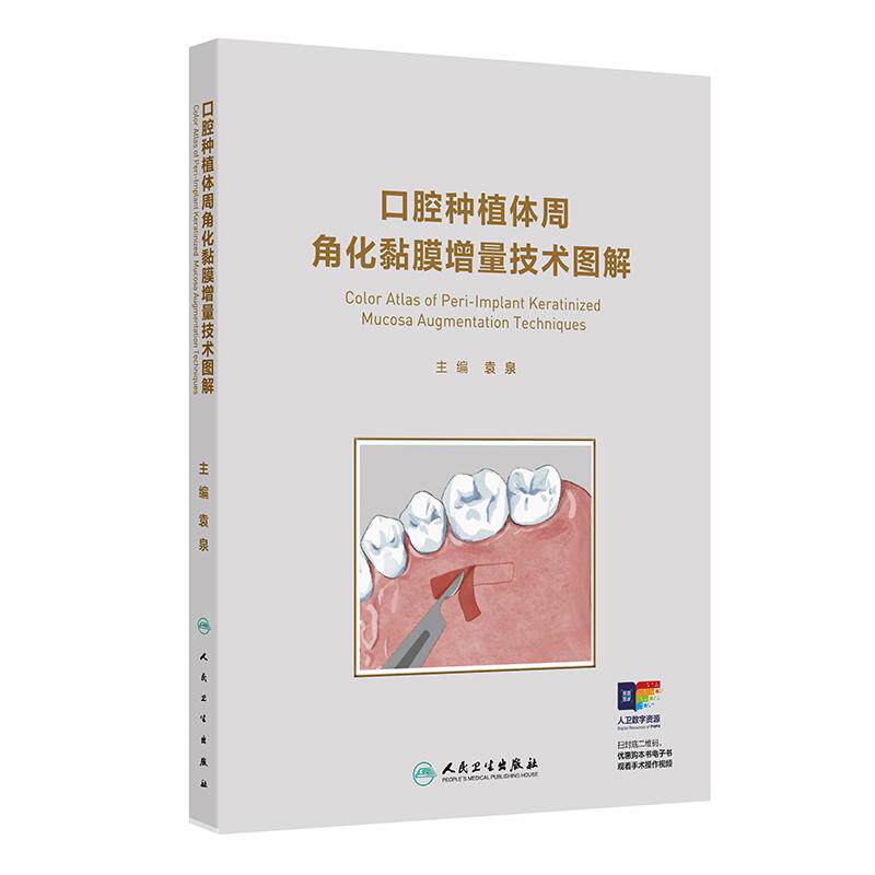口腔种植体周角化黏膜增量技术图解袁泉手术适应症软组织获取上颌前牙美学区典型病例指导彩色专业人民卫生出版社临床口腔种植学