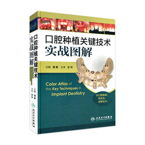 口腔种植关键技术实战图解 彩图版 谭震 供口腔医师研究生进修生用 口腔种植医学参考工具书籍 人民卫生出版社9787117186186