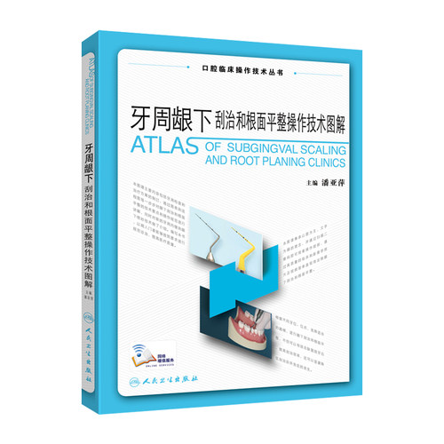 牙周刮治根面平整操作技术人卫