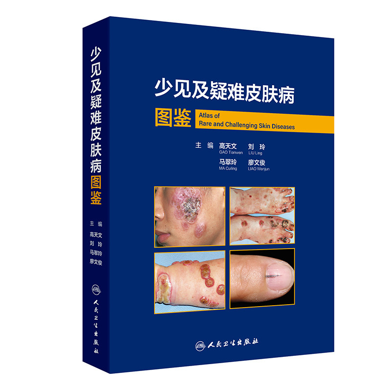 少见及疑难皮肤病图鉴 高天文 西京皮肤医院病理诊断少见疾病临床错诊修正非典型病例中高职医生学习教材人民卫生出版社皮肤科临床