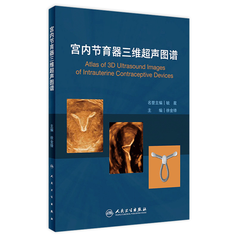 宫内节育器三维超声图谱 详细介绍各类节育器种类三维超声表现 徐金锋主编 图文并茂 实用性强 人民卫生出版 9787117262088