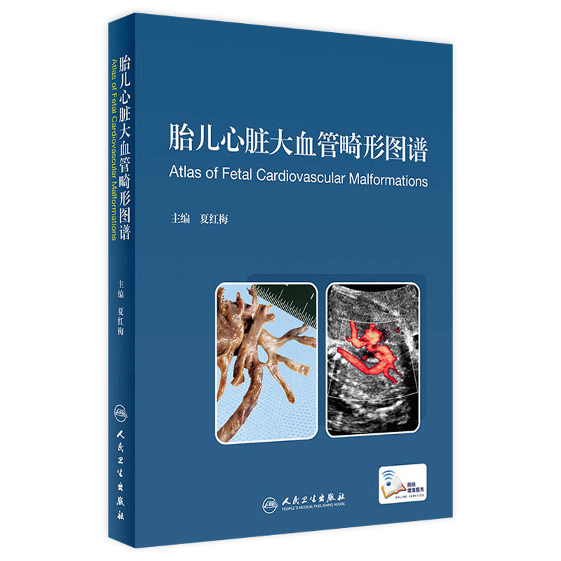 胎儿心脏大血管畸形病理解剖形象化、具体化