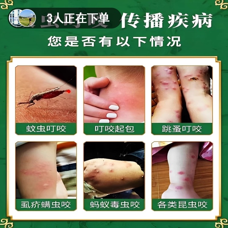 蚊虫叮咬快速止痒消肿驱蚊膏婴儿童宝宝专用药成人孕妇防蚊子神器