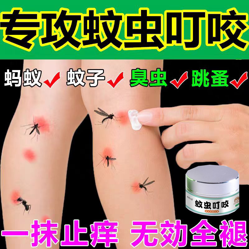 跳蚤咬蚊虫叮咬止痒消红药膏液臭虫蚊子咬儿童成人皮肤过敏外用肿