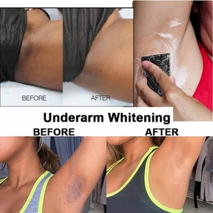 Skin whitening Soap for Hyperpigmentation lightening Soap