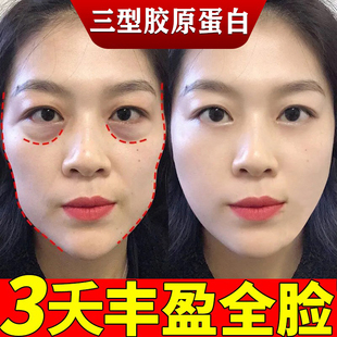 三型胶原面部丰盈精华不回落抗皱紧致去除皱纹法令纹泪沟充实神器