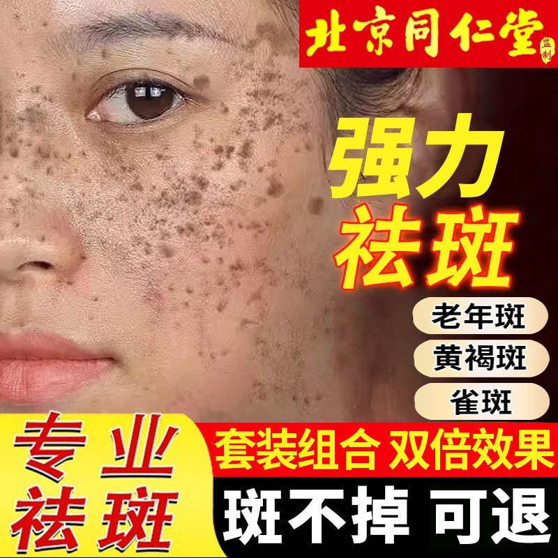 北京同仁堂祛斑霜天下无斑旗舰正品店祛黄褐斑雀斑老年斑强力去除