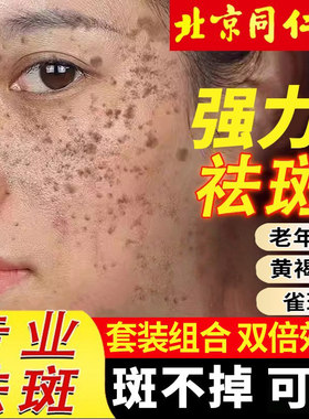 北京同仁堂美白祛斑霜强力去除