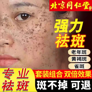 北京同仁堂祛斑霜天下无斑旗舰正品店祛黄褐斑雀斑老年斑强力去除