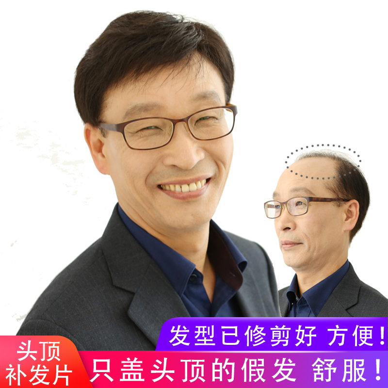 全手織中老年男士假發(fā)頭頂補(bǔ)發(fā)片無痕遞針短發(fā)定做全真人發(fā)塊脫發(fā)
