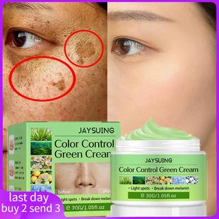 Whitening Freckles Cream Remove Melasma Dark Spot Lightening