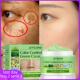 Freckles Dark Cream Whitening Remove Melasma Spot Lightening