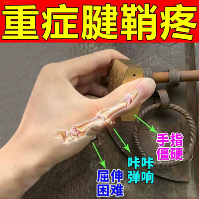 云南白药药膏膏药贴舒筋活血止痛化瘀消肿风湿关节痛膏
