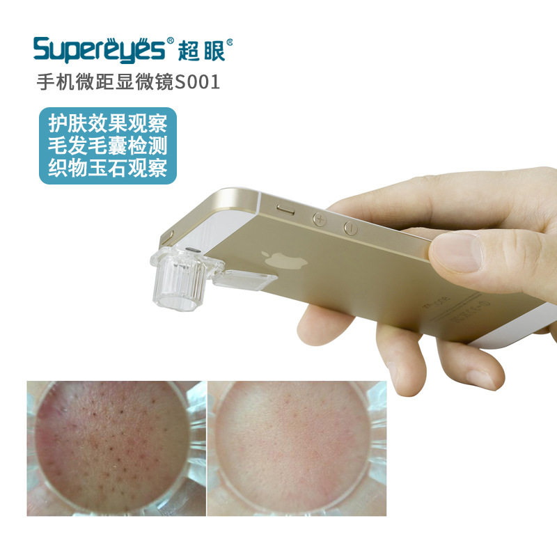 超眼皮肤毛囊头发头皮手机放大镜显微镜微距检测毛孔黑头镜头s001
