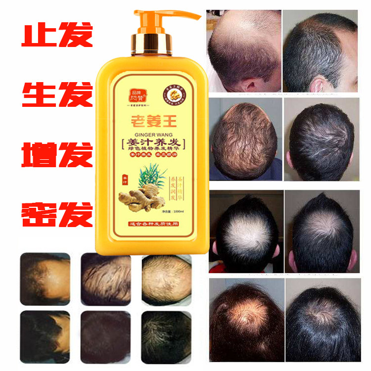 白发转黑发秃顶头发营养液护理理发店专用头发洗直在类目 美发护发/假发, 洗发护发（新）, 洗发水中 - 来自Buy2taobao.com提供专业的淘宝代购服务