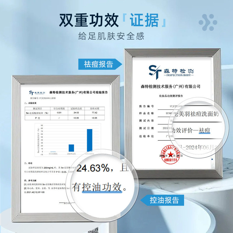 韩伦美羽控油祛痘洗面奶温和清洁去黑头改善油痘肌氨基酸洁面乳图片