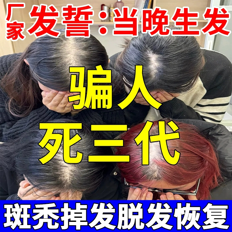头发生长液斑秃鬼剃头专用液防脱育发生长液快速增发密发护生发剂