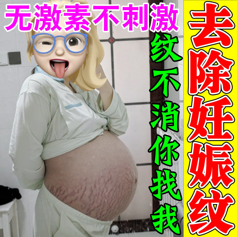 妊辰纹消除去妊娠纹紧致肚皮孕妇专用修复霜腹部大腿长肥胖纹红纹