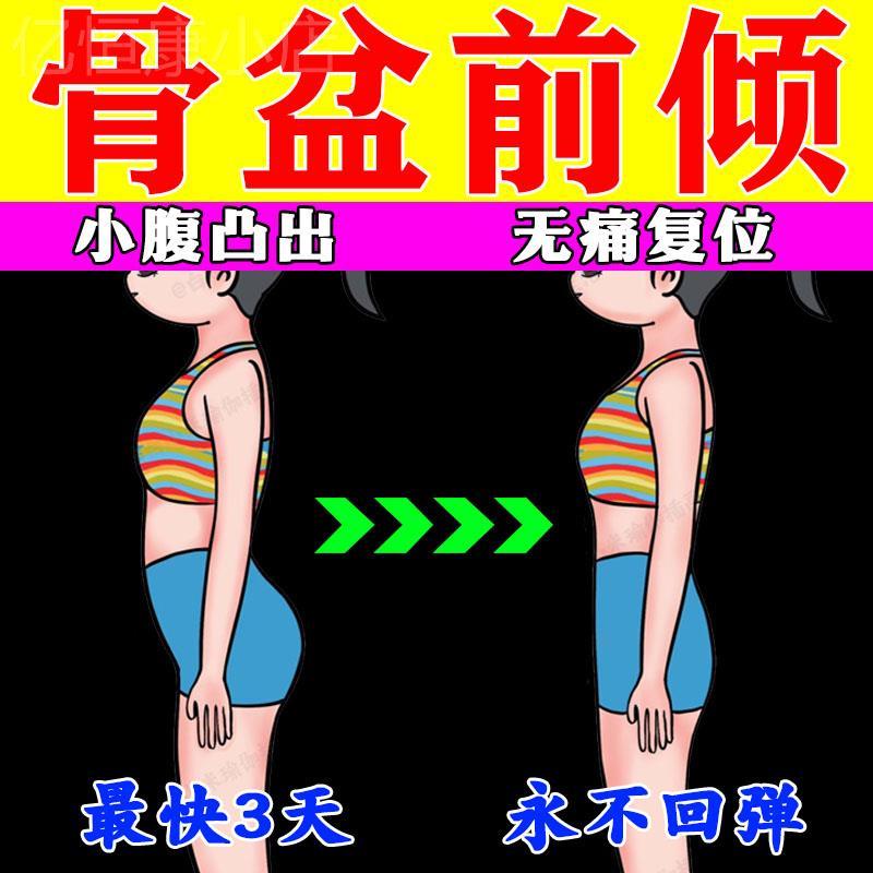 【小红书推荐】骨盆前倾矫正器盆骨小腹突出修复神器xo型腿矫正贴