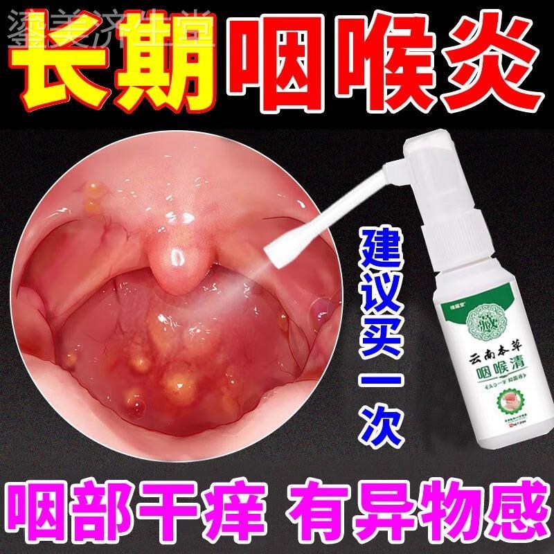 治疗烟炎慢性咽炎除根咽喉炎有痰异物感特效神器肿痛滤泡增生喷剂