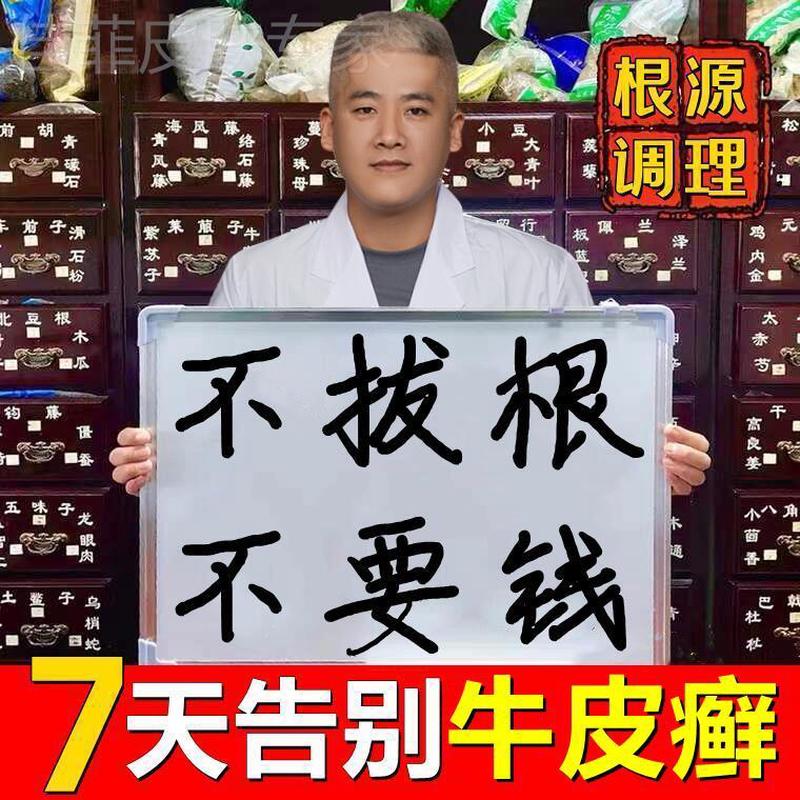 东方神朗药膏正品湿疹止痒去牛皮根癣根皮肤湿疹乳膏抑菌膏瘙痒藓