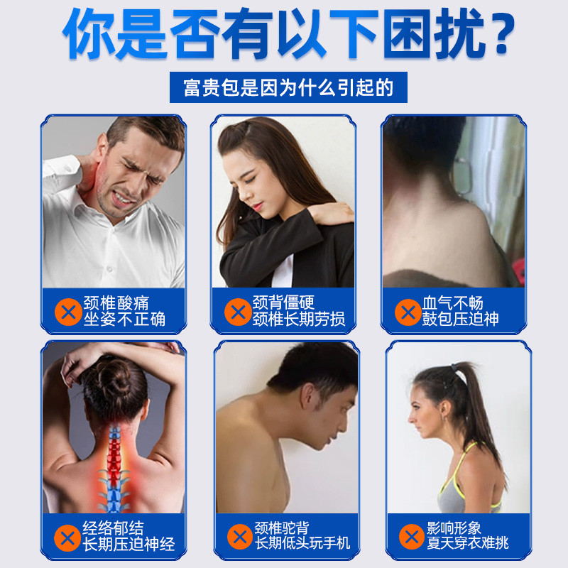 治疗富贵包神器【100%拨根】疏通消除颈椎鼓包肩膀酸痛改善驼背贴