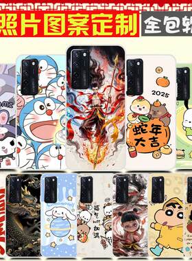 中兴AXON 20手机壳卡通防摔软胶DIY定制 ZTE A20保护壳 A2121手机套 来图定制照片