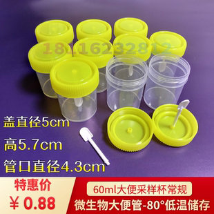 实验耗材60ml无菌大便样本采集管带勺加厚螺纹防漏检测医院化验