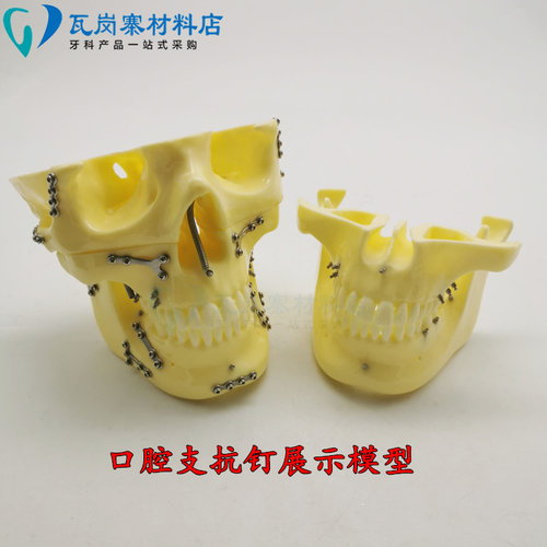 牙科练习种植支抗模型医学