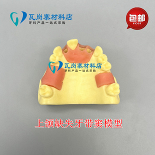 牙科材料牙齿模型口腔种植练习软牙龈上颌缺失牙种植教学示教缝合